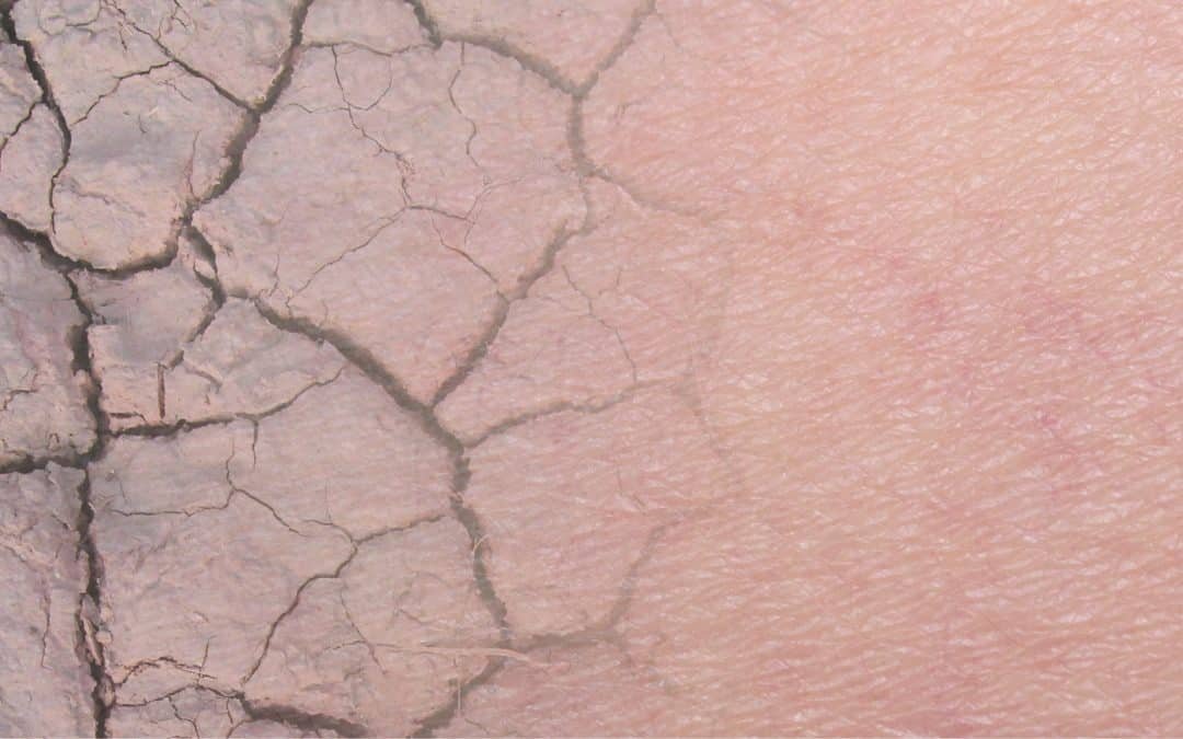 Dois-je traiter en priorité mes rides ou mon relâchement cutané ?