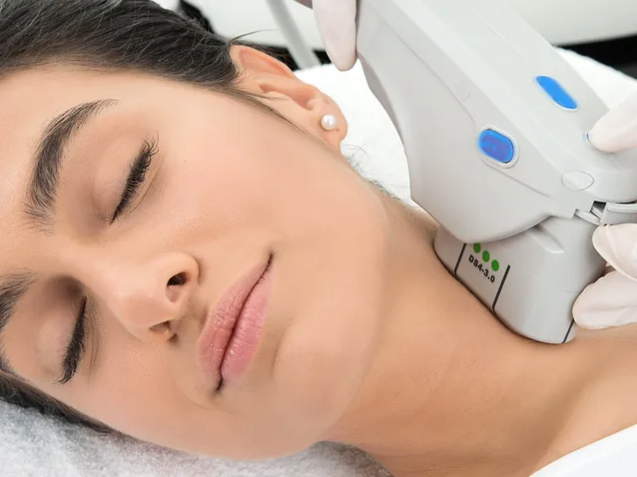 Séance de HIFU visage par ultrasons focalisés au Centre Thetys