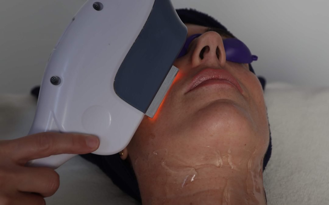 Révélez Votre Éclat : Transformez Votre Peau à Cannes avec le Photorajeunissement chez Thetys