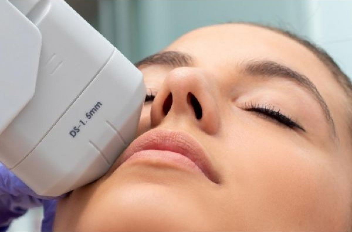 Traitement HIFU RF Centre Thetys Cannes