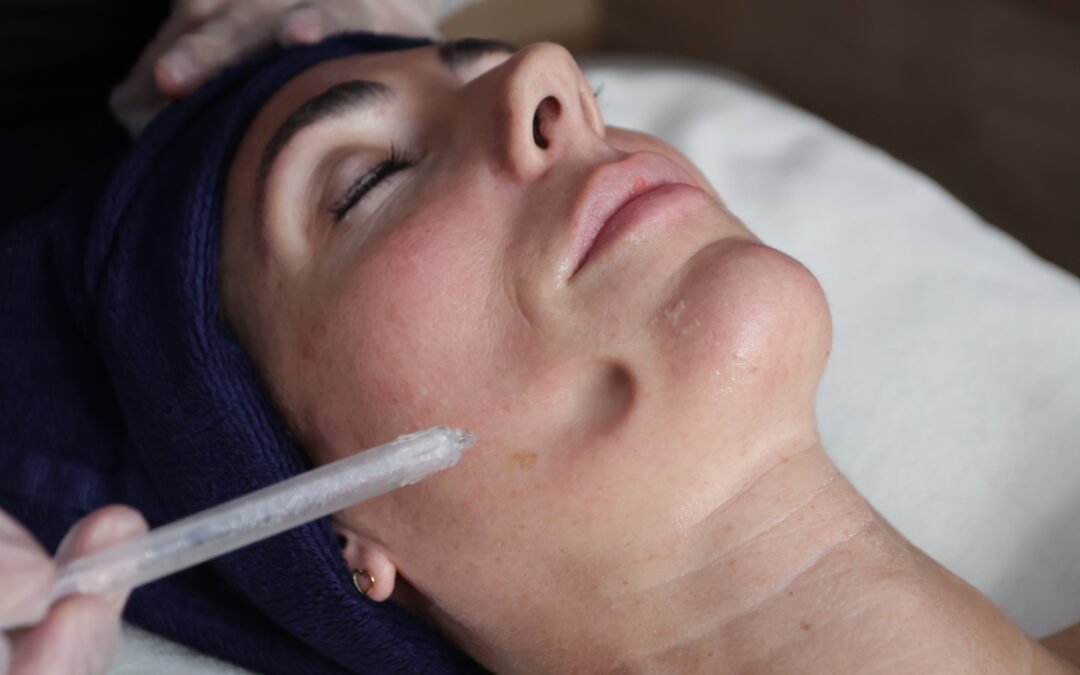 JetPeel à Antibes : le soin pour une peau éclatante sans aiguille ni injection