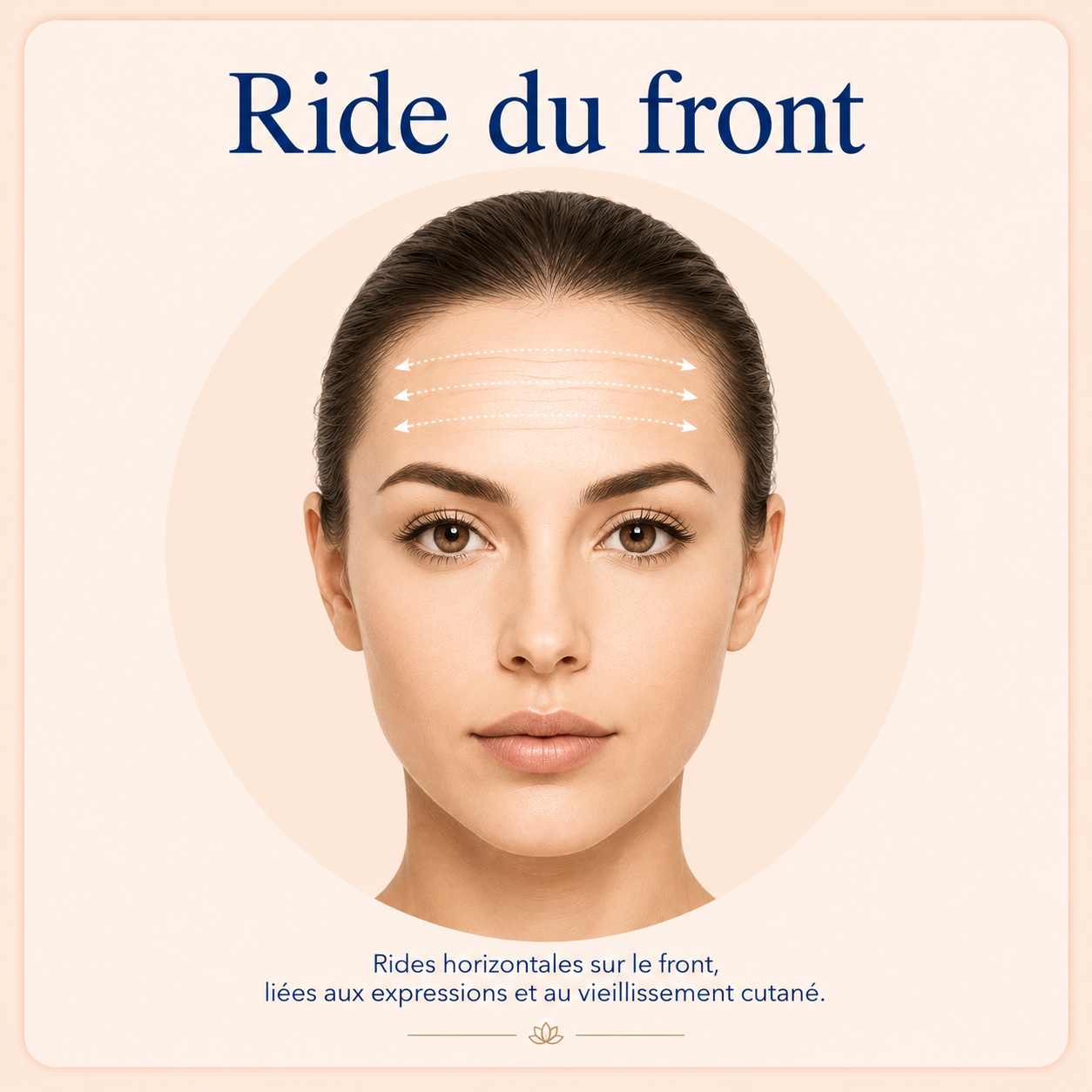 Soin Lift Coréen au Fil de Collagène | Centre Thetys 3 Soin Lift Coréen ride du front au Centre Thetys