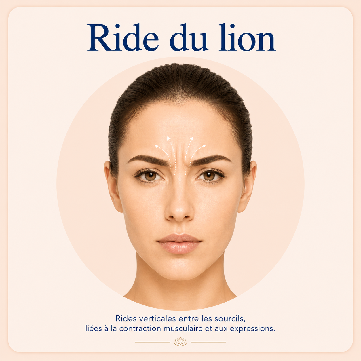 Soin Lift Coréen au Fil de Collagène | Centre Thetys 4 Soin Lift Coréen ride du lion au Centre Thetys
