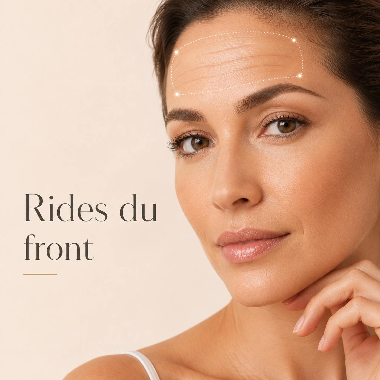 Microneedling Axion contre les rides du front au Centre Thetys