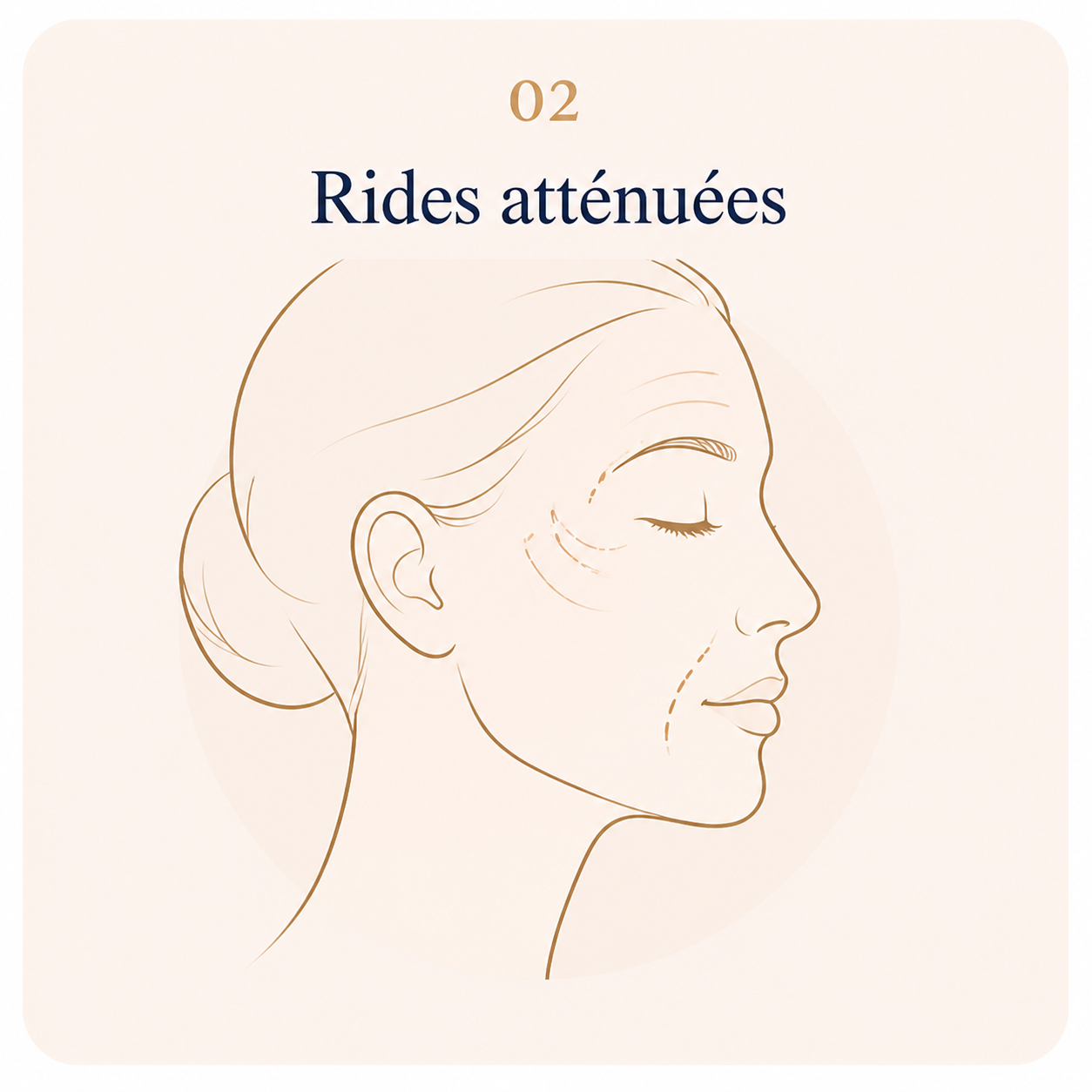 HIFU rides atténuées au Centre Thetys Antibes