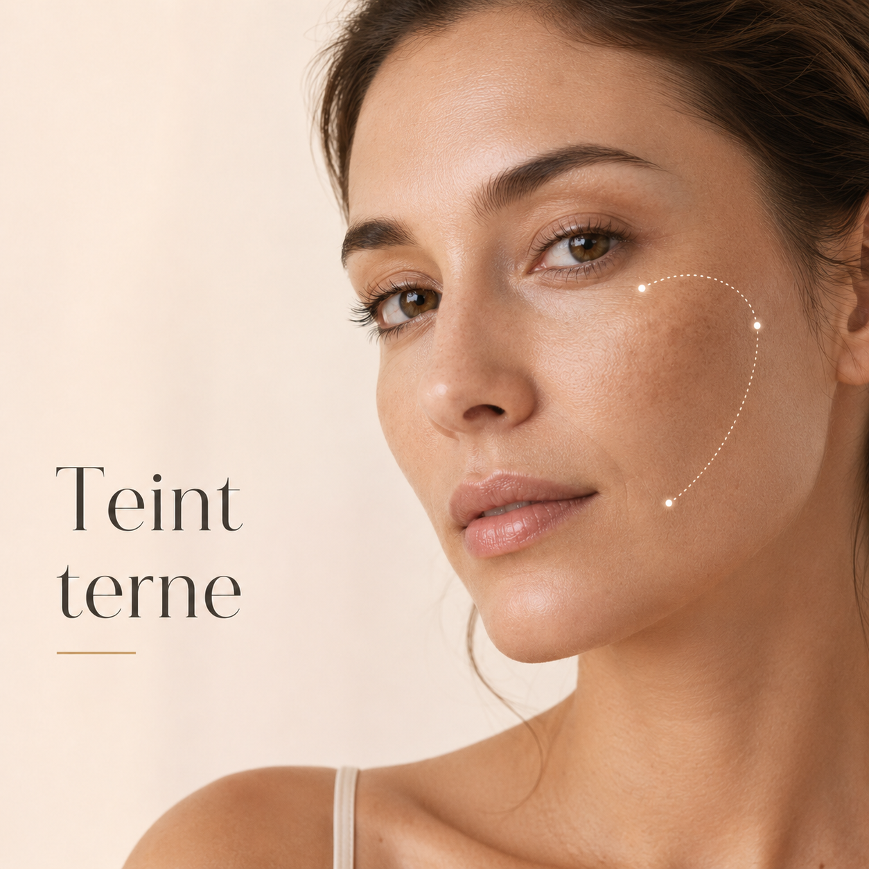 Microneedling Axion pour le teint terne au Centre Thetys