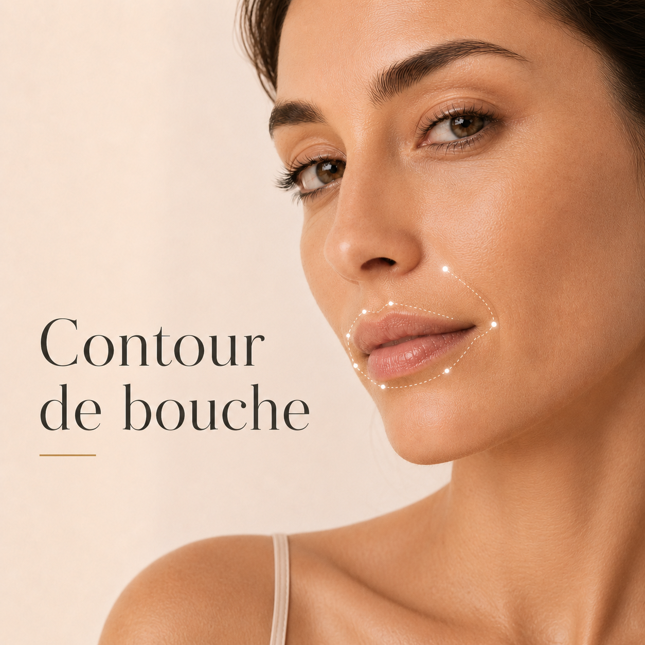 Microneedling Axion contour de la bouche au Centre Thetys