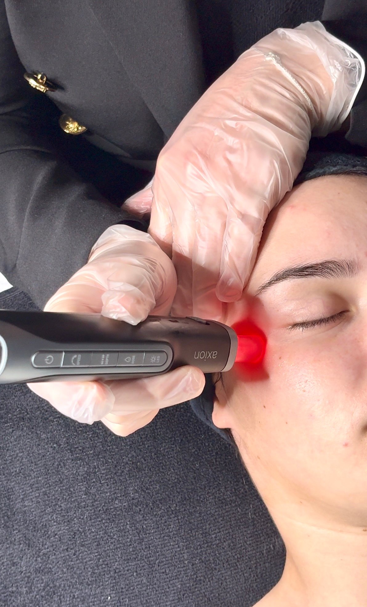 Stylo Axion Mesoestetic en action lors d'une séance microneedling au Centre Thetys