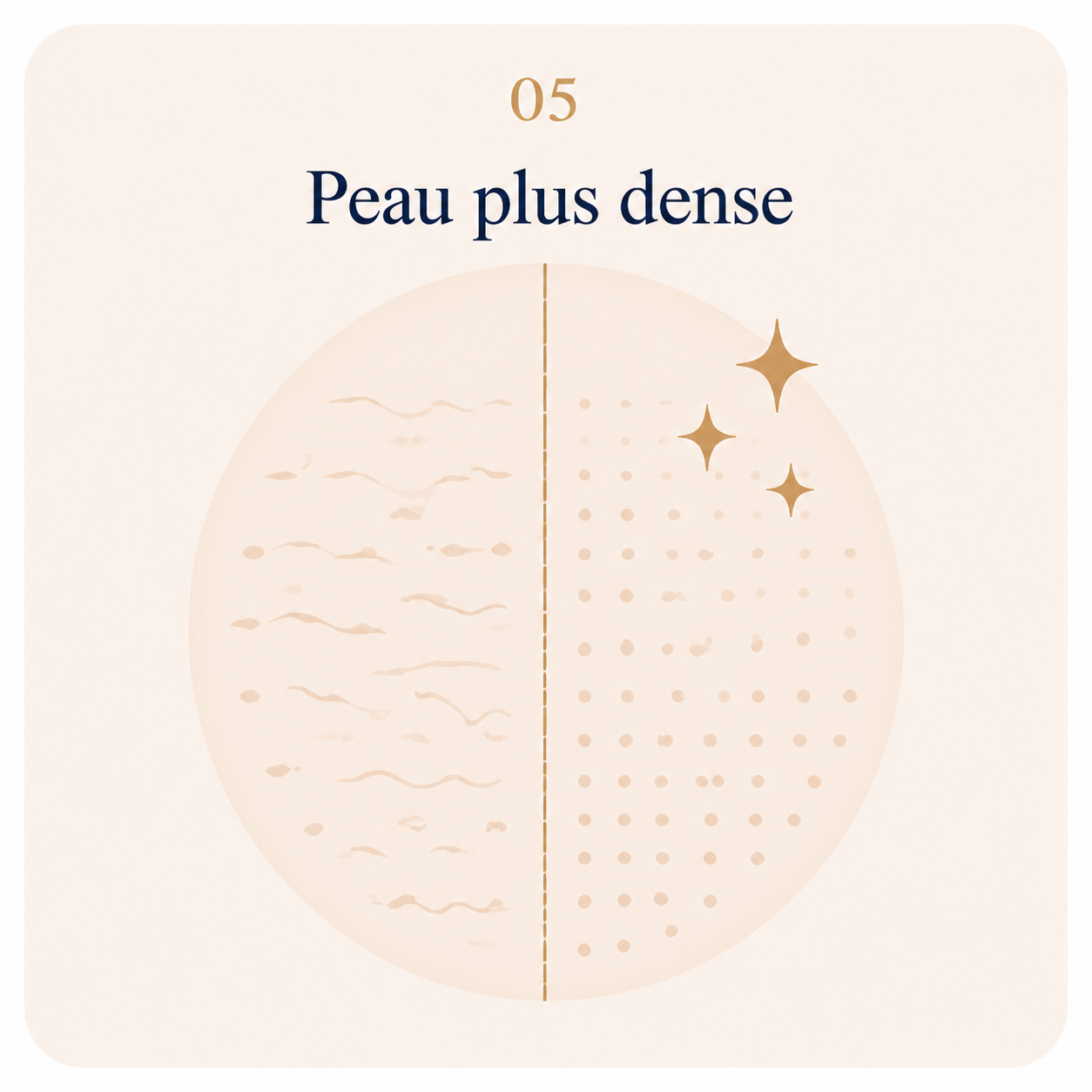 HIFU peau plus dense au Centre Thetys Antibes