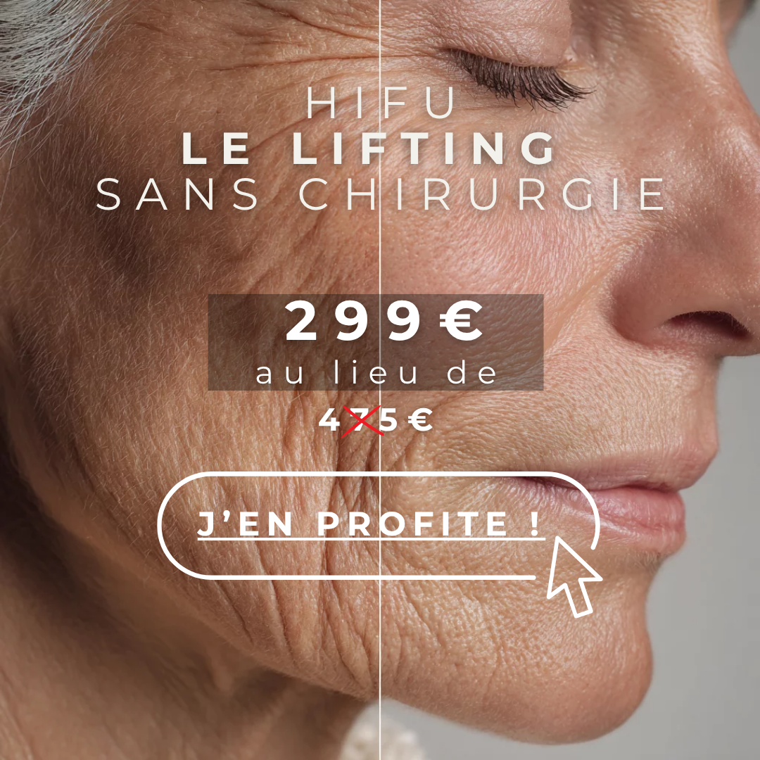 HIFU 299€ - Le lifting sans chirurgie
