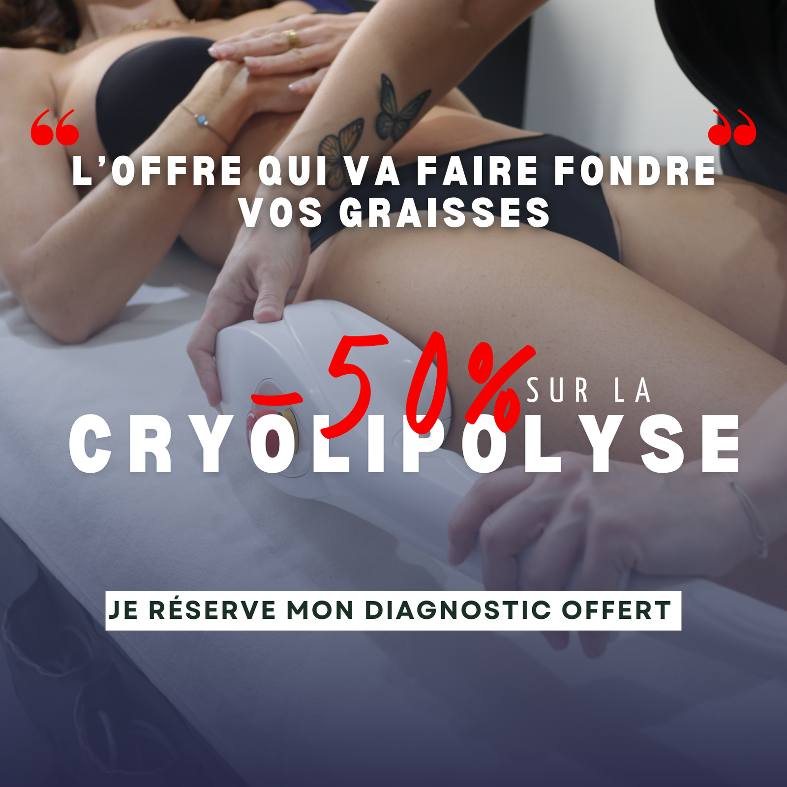 pop-up-cryolipolyse-mai-2026