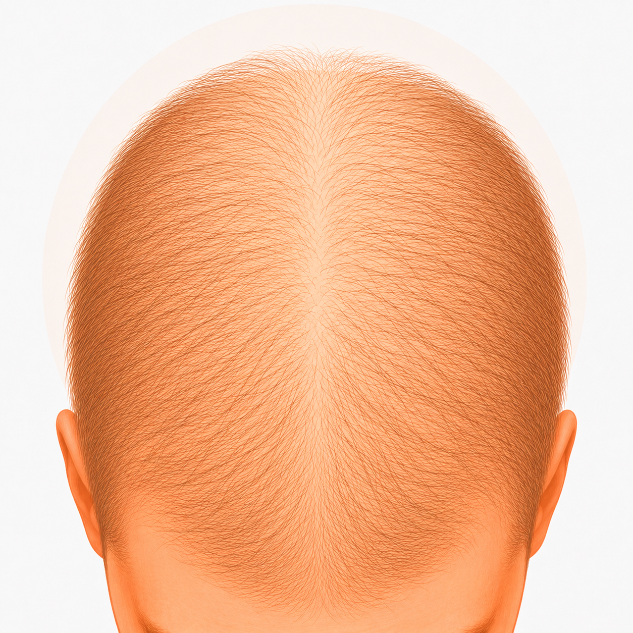 Microneedling capillaire : réveiller ses follicules et retrouver de la densité 7 Microneedling capillaire : cheveux fins et fragiles