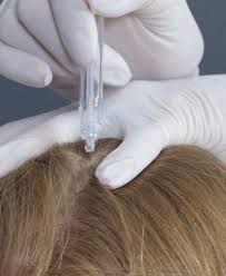 JetPeel Cheveux Centre Thetys
