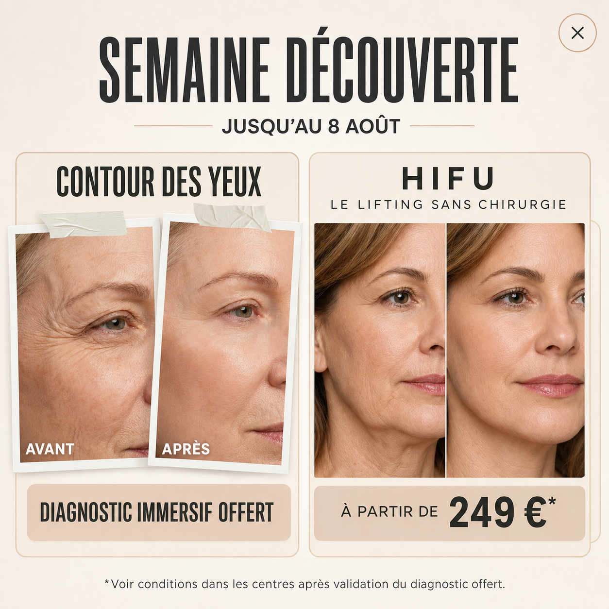 Semaine Découverte : contour des yeux offert et HIFU dès 249 € jusqu'au 8 août au Centre Thetys
