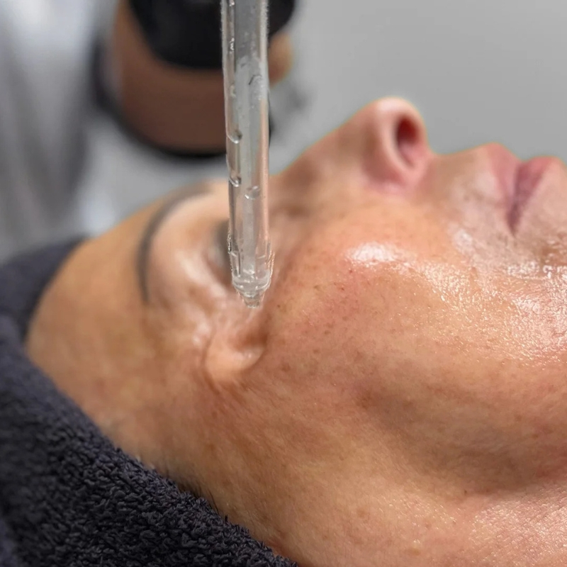 Soin JetPeel contour des yeux au Centre Thetys