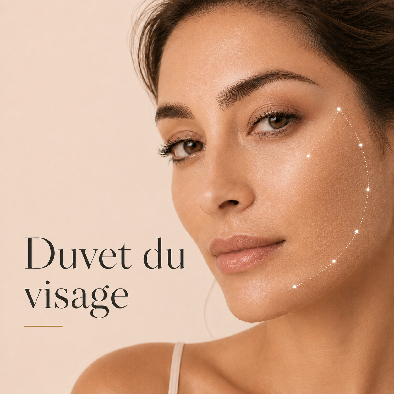 Electrolyse, l'épilation définitive sans douleur 7 Électrolyse du duvet du visage au Centre Thetys