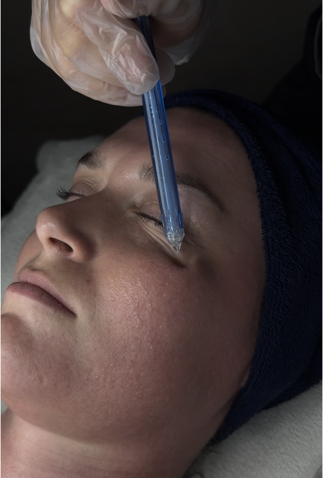 Semaine Découverte : Contour des Yeux offert & HIFU dès 249 € jusqu'au 8 août | Centre Thetys 1 Soin du contour des yeux en cabine au Centre Thetys