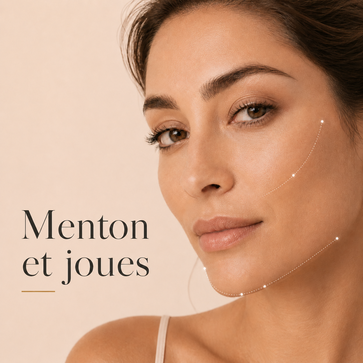 Electrolyse, l'épilation définitive sans douleur 5 Épilation définitive du menton et des joues par électrolyse au Centre Thetys
