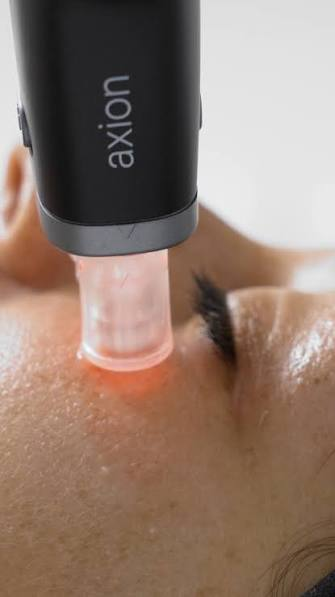 Appareil Axion Mesoestetic pour le contour des yeux au Centre Thetys