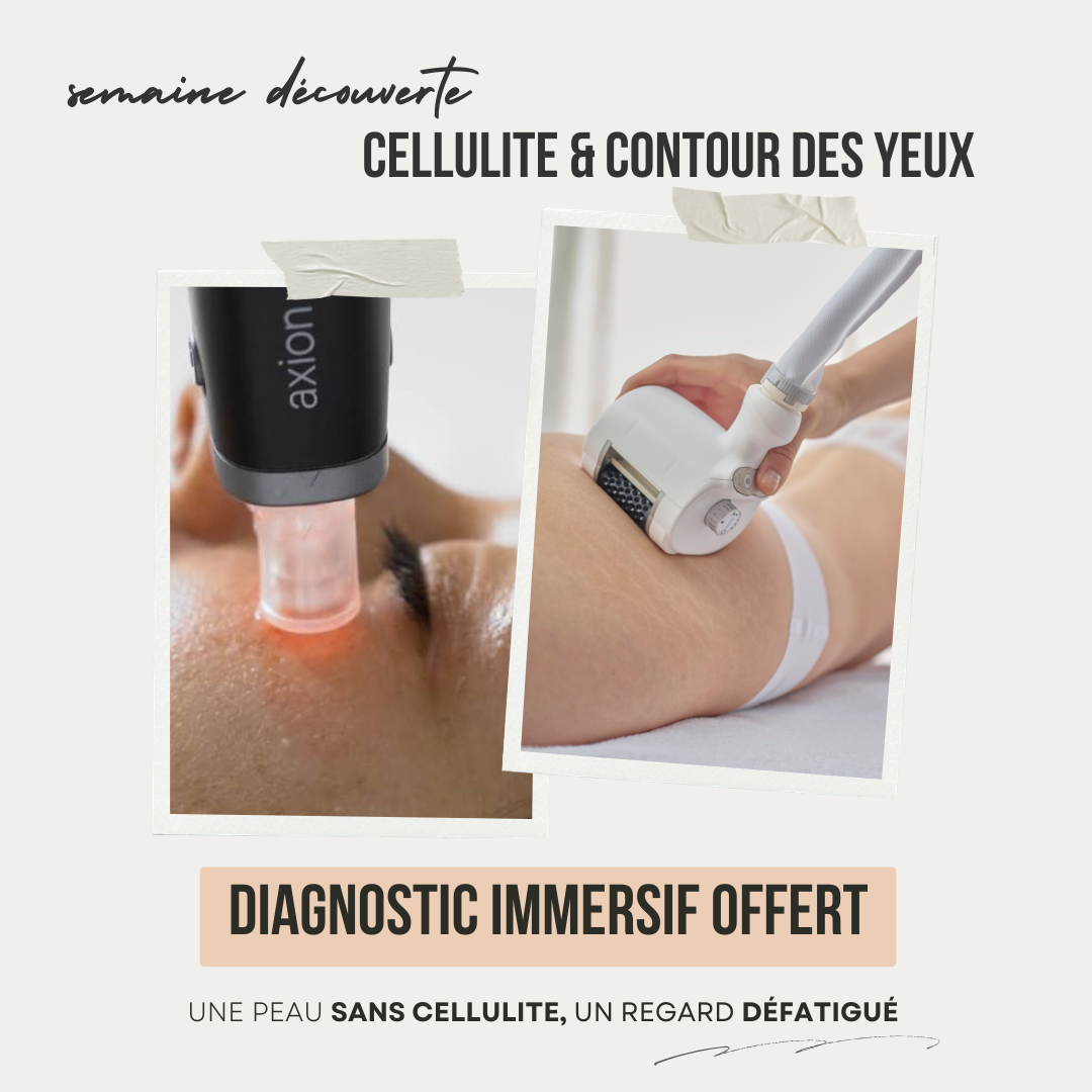 Semaine Decouverte du 13 au 25 juillet : cellulite et contour des yeux, diagnostic immersif offert