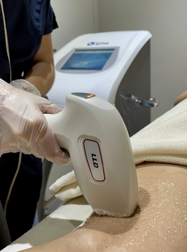 S&eacute;ance d'&eacute;pilation laser Keros Alpha en cabine au Centre Thetys P&eacute;gomas