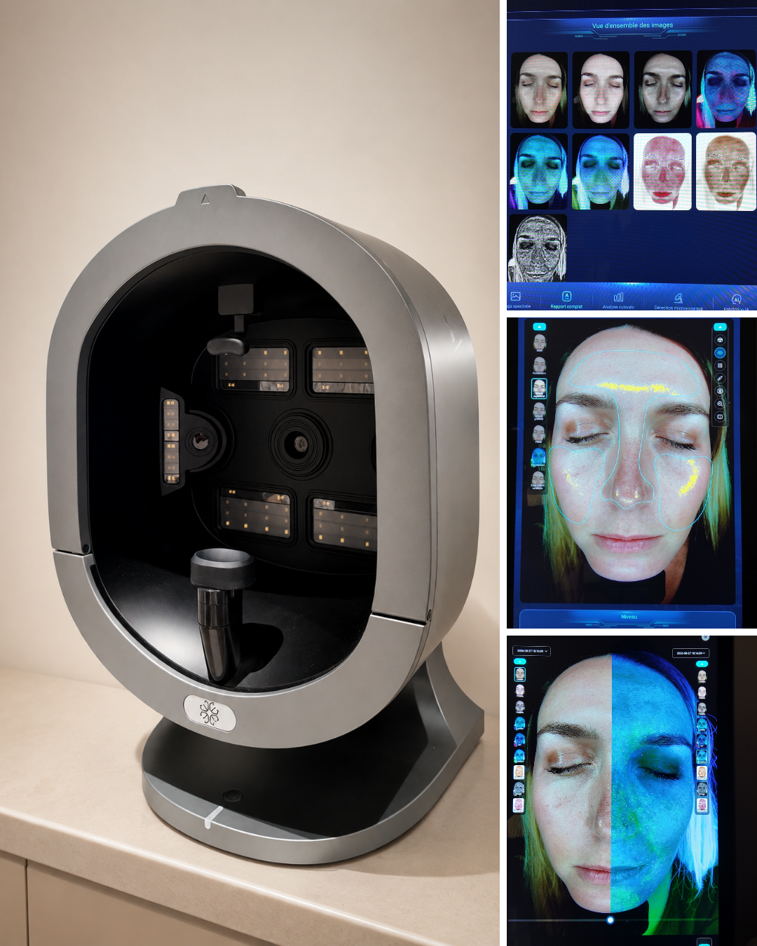 Auto-diagnostic beauté en ligne : votre plan sur-mesure en 60 secondes 1 Scanner de peau et écrans d'analyse du diagnostic Centre Thetys