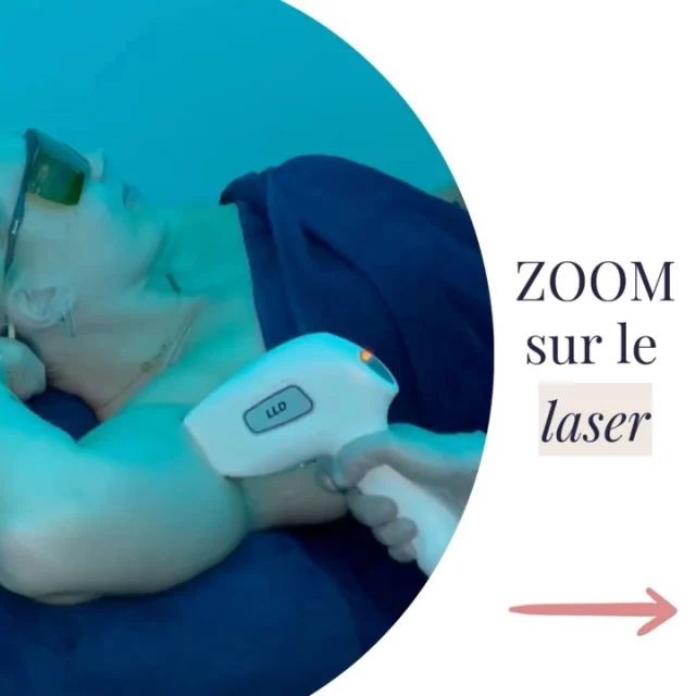 Dites adieu aux poils indésirables avec l’épilation définitive au laser ✨👙! 
Découvrez notre technique innovante pour une peau lisse et durable, exclusivement dans notre centre à Pégomas. 
Prenez rdv dès maintenant (lien en bio) pour votre Consultation d’information ⬆️ #laser #epilationdefinitive #epilationlaser #centrebeauté #solutioncorps