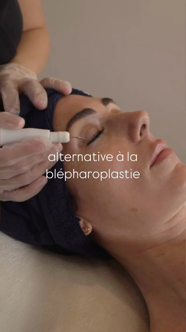 ✨ Découvrez la révolution Plasma Pulse, l’alternative naturelle au lifting✨
Cette technologie innovante stimule la régénération naturelle de la peau, combat les signes de l’âge et booste votre éclat en douceur. 🌟 
Sans chirurgie, sans douleur, des résultats visibles rapidement.

💡 Envie d’en savoir plus sur ce soin révolutionnaire ? Profitez de votre Diagnostic Offert pour déterminer le traitement idéal pour vous. Prenez rendez-vous dès maintenant (lien en bio) ! 💆‍♀️

#soinduvisage #plasmapulse #lifting #liftingnaturel #solutionbeauté #antiage #soinnaturel #skincare