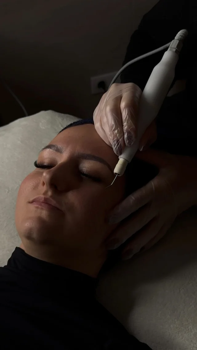 Et il est très important d’écouter cette personne 😌#pov #microneedling #plasmapen #jetpeel #soinvisage