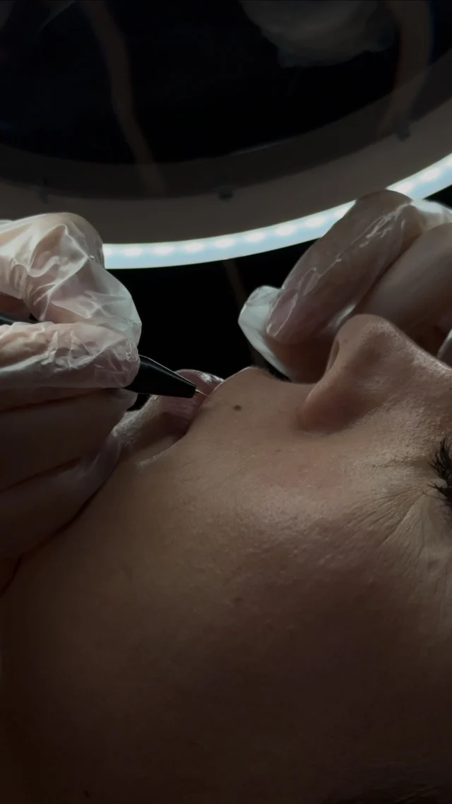 La technologie pour dire adieu aux poils, sans douleur et en toute tranquillité 💁🏻‍♀️ #epilationdefinitive #electrolyse #sopk #epilations #summertime