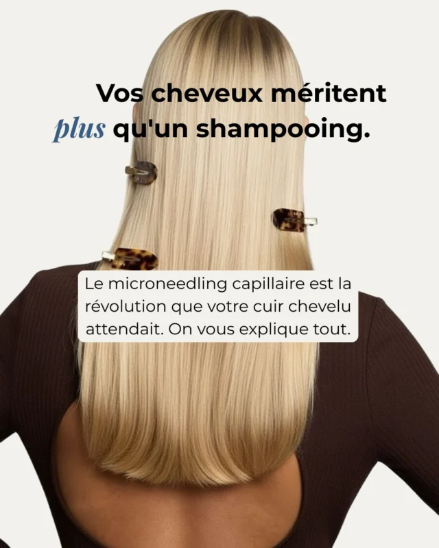 Cheveux plus fins, perte de densité, chute qui s’installe ? ✨
Le microneedling capillaire stimule le cuir chevelu grâce à des micro-stimulations ciblées qui favorisent le renouvellement naturel et optimisent l’action des actifs capillaires.✔ Stimule le cuir chevelu
✔ Favorise un environnement propice à des cheveux plus forts
✔ Aide à accompagner la densité capillaire
✔ Protocole non invasifParce qu’un cuir chevelu en pleine santé est la base de beaux cheveux 💆‍♀️✨#microneedlingcheveux #chutecheveux #densitecapillaire #soincapillaire