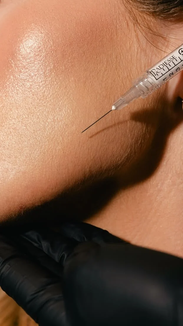 💉 « Je viens de faire des injections, est-ce que je peux quand même faire des soins ? »La réponse d’Élodie : oui ✨Loin d’être incompatibles, certains soins peuvent même sublimer vos résultats.Le JetPeel, par exemple, infuse en profondeur des actifs ciblés sans aucune aiguille, pour une peau hydratée, repulpée et éclatante qui prolonge et maximise les bénéfices de vos injections.Votre visage mérite une approche globale, pensée pour révéler le meilleur de chaque geste. #injections #botox #jetpeel #soinvisage #acidehyaluronique